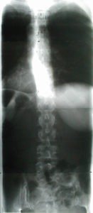 DKpreopAP 131x300 - Case Example 10