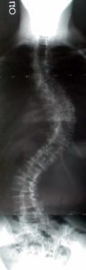 MLpreopAP 96x300 - Case Example 8